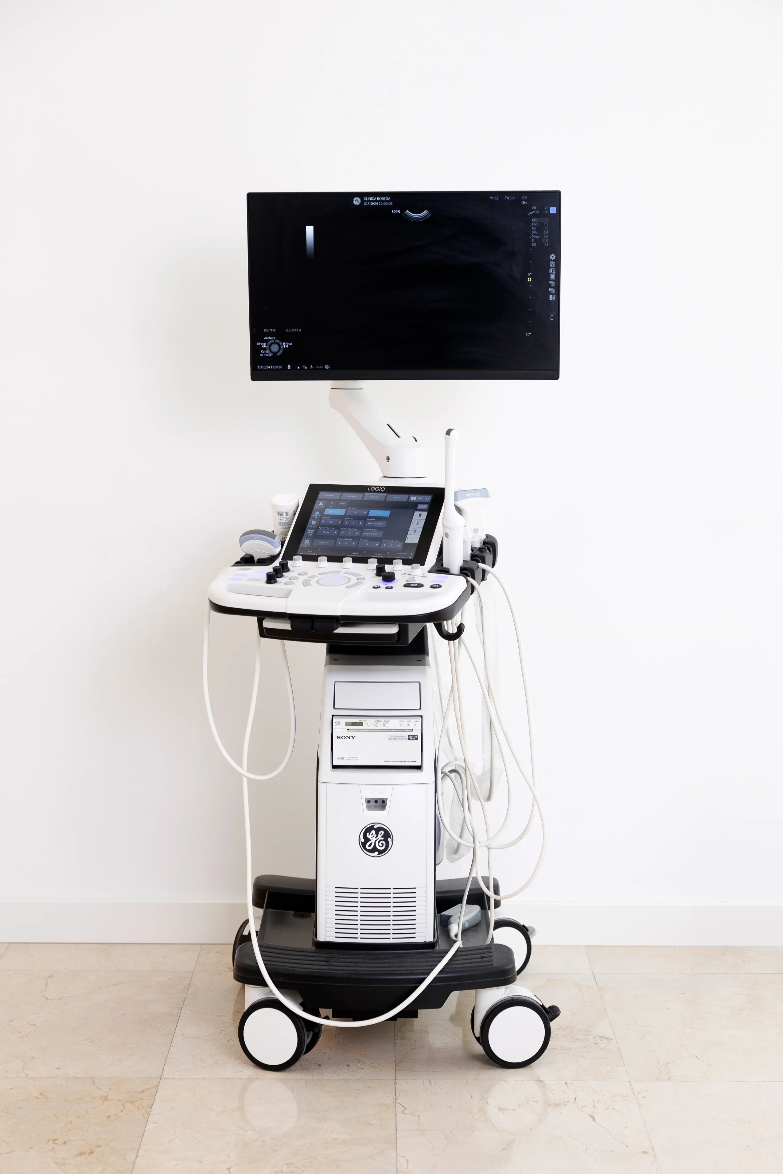 Tratamiento Endolift en Clínica Robega Madrid