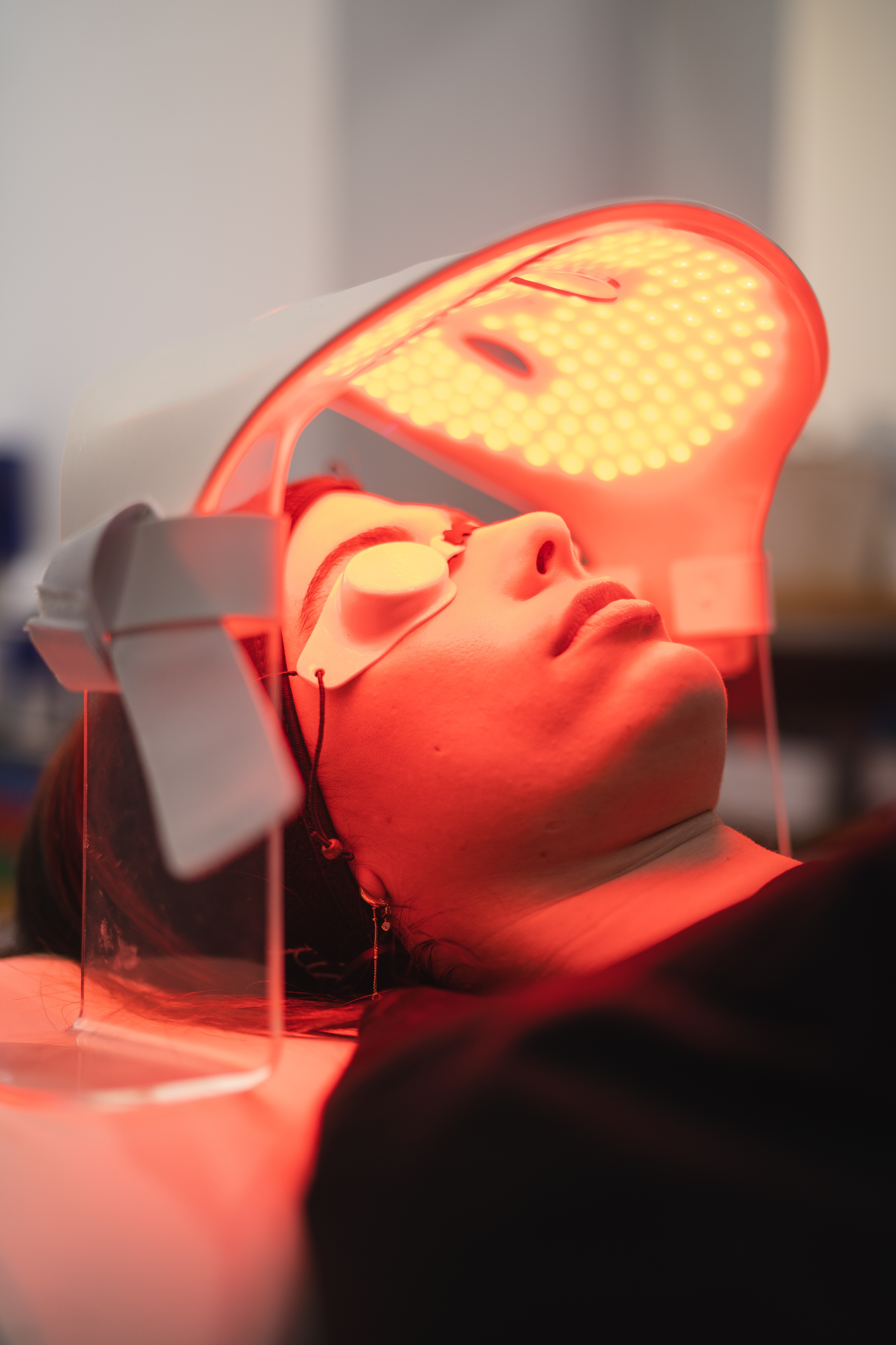 Hydrafacial - imagen 2
