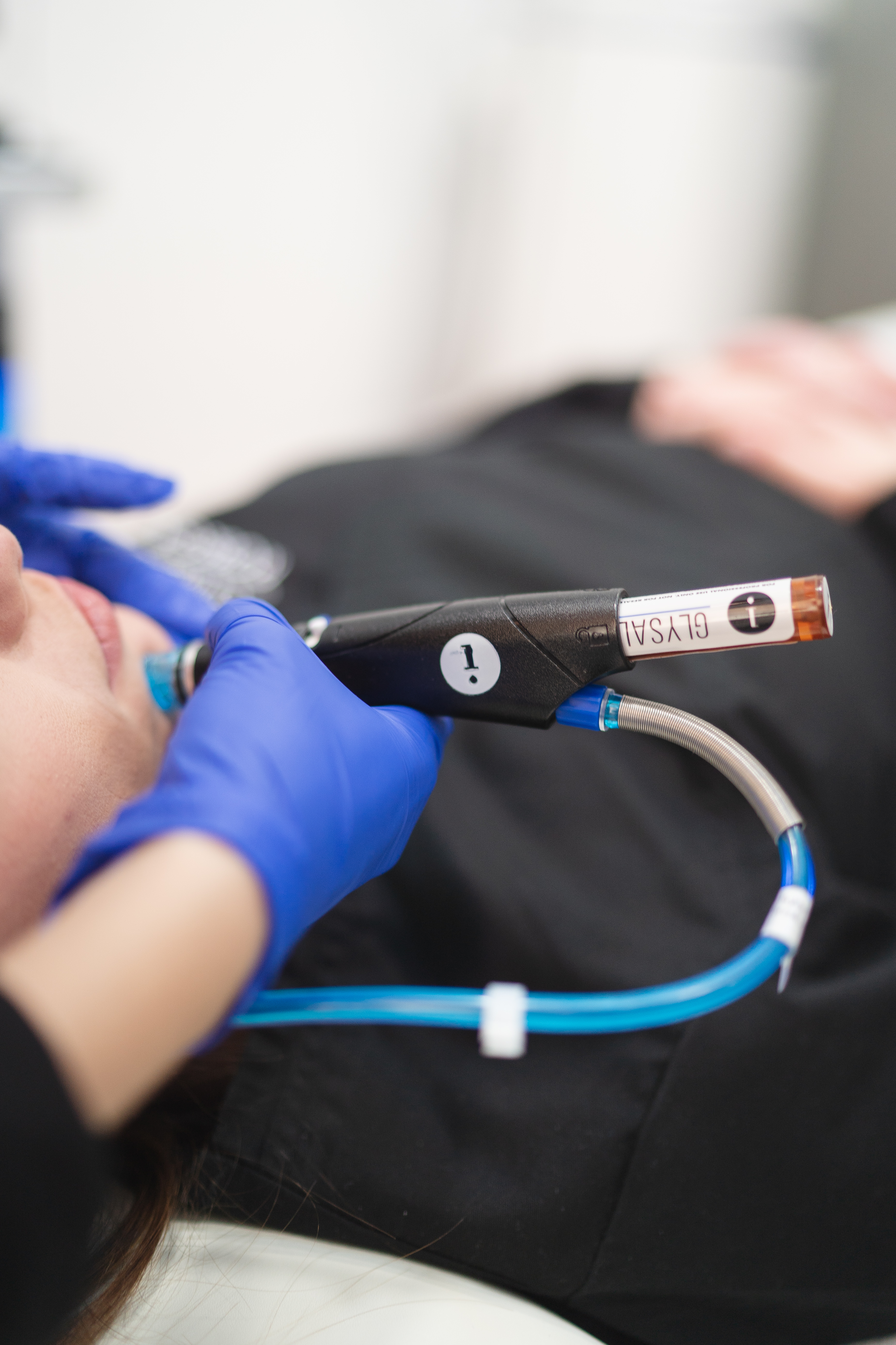 Tratamiento Hydrafacial en Clínica Robega Madrid
